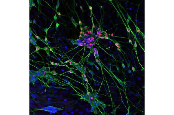 New Therapeutic Strategies for Spinal Muscular Atrophy